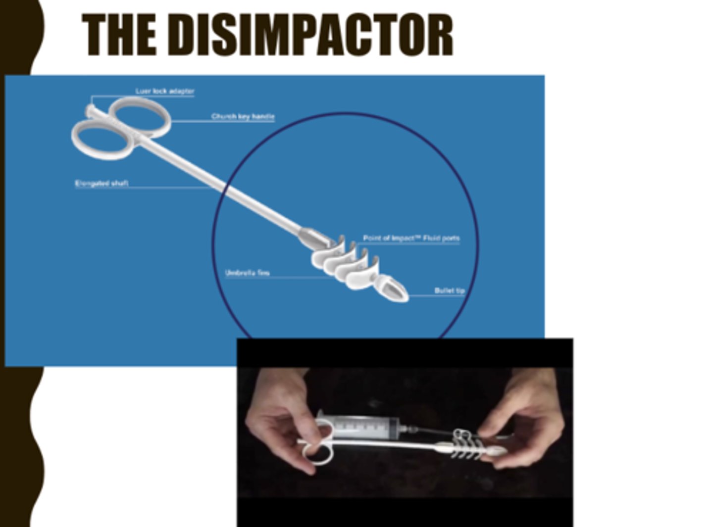 <p>-digital disimpaction (painful) and colon evacuation</p><p>-device: The Disimpactor</p><p>-if others fail: colonoscope with snare to break it up</p><p>-if tenderness/bleeding occur, may indicate perforation or ischemia- SURGERY</p>