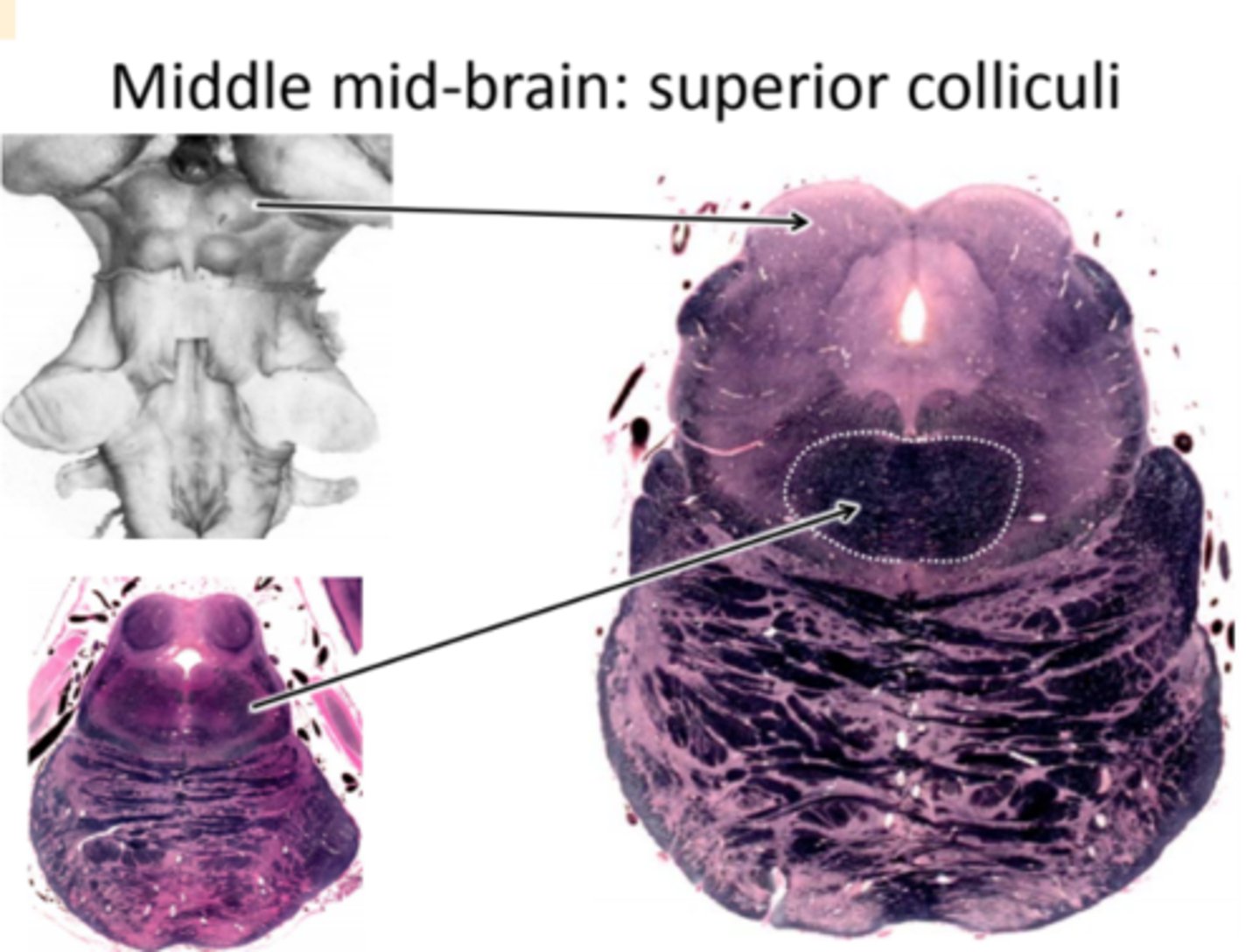 <p>- Superior colliculus is present: flat, not round. It's not outlined in black like the inferior colliculus<br>- Cerebral aqueduct is round rather than pointy<br>- Middle cerebellar peduncle is almost gone<br>- Superior cerebellar peduncle is crossing midline: Decussation of the Superior cerebellar peduncle</p>