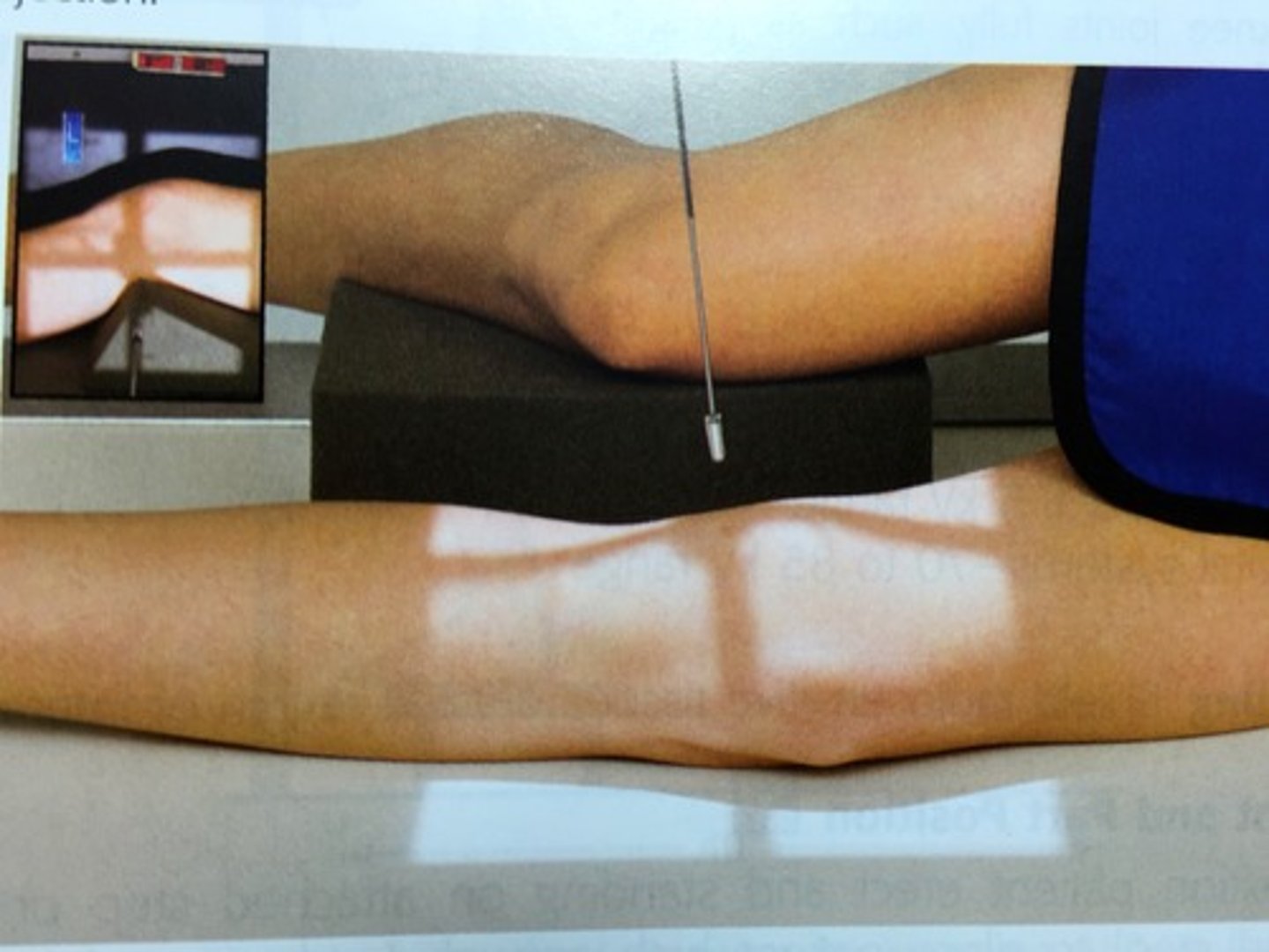 <p>1. Patient lies supine on the x-ray couch and turns onto the affected side so that the lateral aspect of the knee is in contact with the IR.</p><p>2. The affected knee is flexed through either 45 or 90 degrees and the leg is turned to superimpose the femoral condyles.</p><p>3. A small pad should be placed under the ankle joint to ensure the tibia is parallel to the x-ray couch.</p>