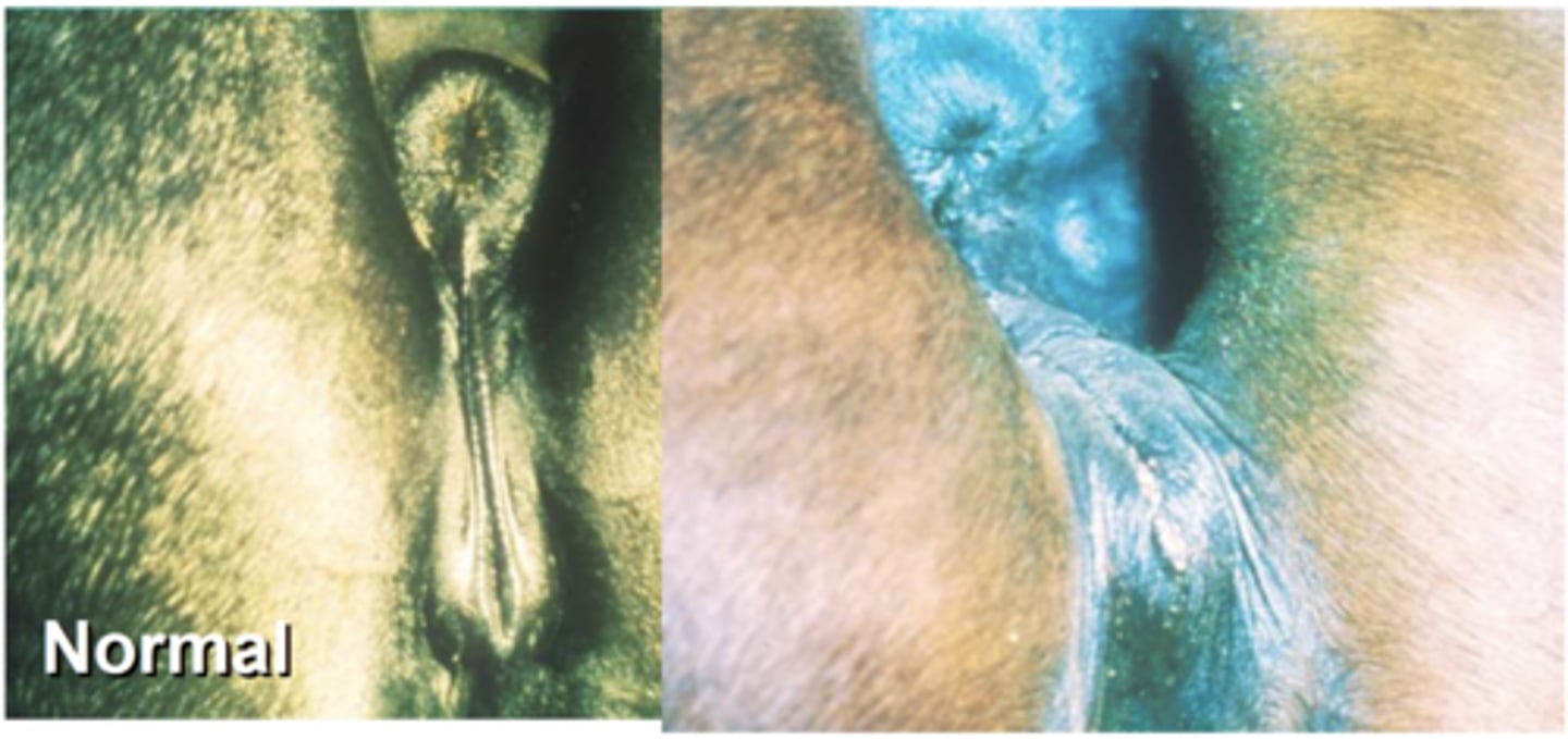 <p>All Species can move via ascending infection into the uterus or be deposited into anterior vagina via venereal transmission. Not all mares develop endometritis, Critical to the disease is the presence of an open cervix and anatomical defects in the perianal area allowing gaping of the vulva (Occurs as mares age/have poor Body Condition), allows urine pooling in vagina</p>