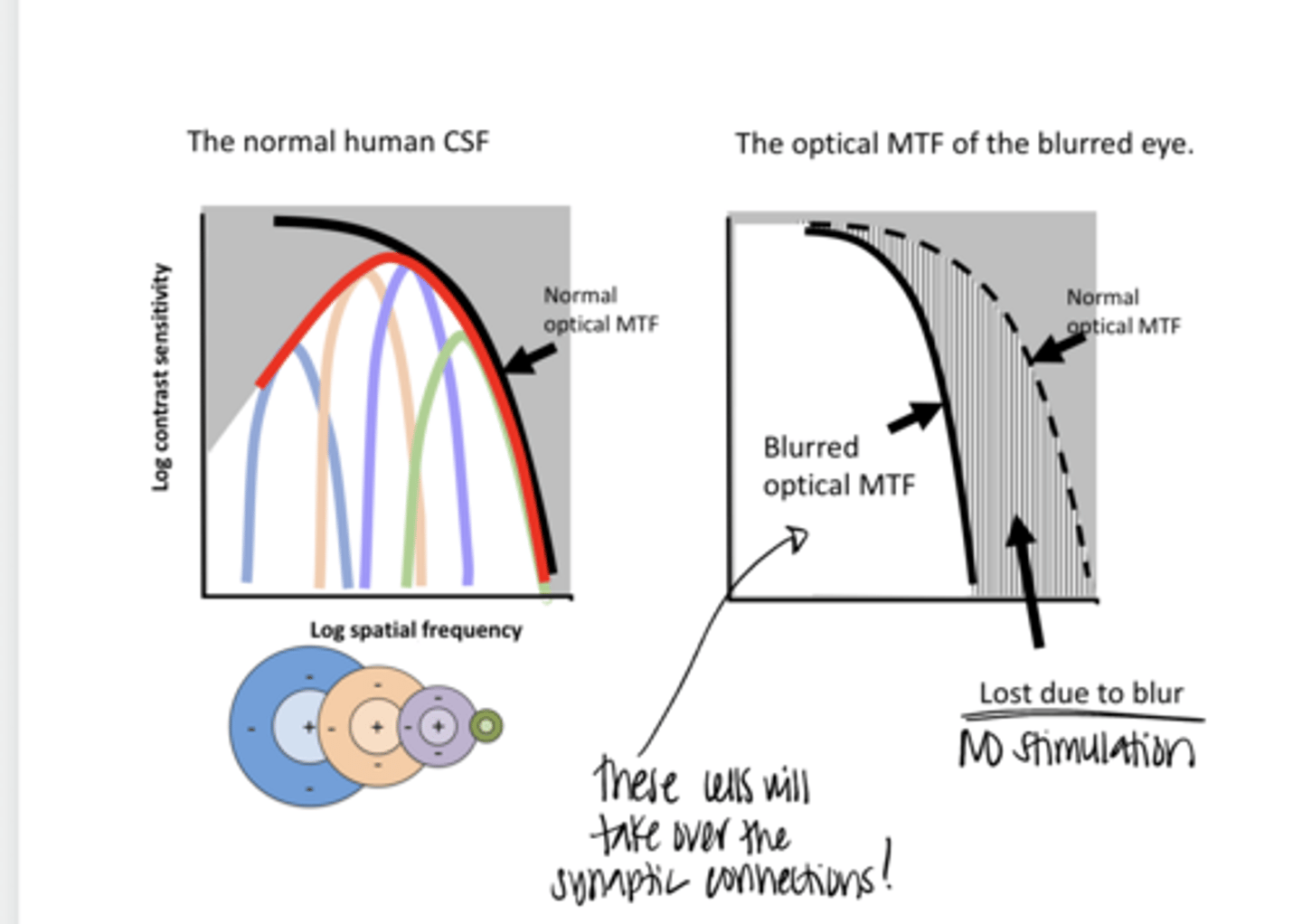 <p>Normal Human CSF v CSF of Blurred Eye (Pic)</p>