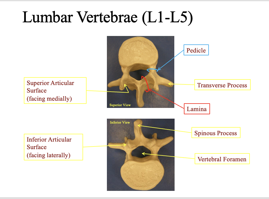 <p>Superior articular surface</p><ul><li><p>faces medially close to the spinous process (facing)</p></li></ul><p>Inferior articular surface</p><ul><li><p>faces laterally (sideways) away from the spinous process on the bottom</p></li></ul><p>Pedice</p><ul><li><p>rounded ara by the vertebral foramen</p></li></ul><p>Transverse process</p><ul><li><p>the most lateral horned areas&nbsp;</p></li></ul><p>Lamina</p><ul><li><p>he cercumferance combining the spinous process and the articular surfaces&nbsp;</p></li></ul><p>Pinous process</p><ul><li><p>the most posteiror/ jutted part</p></li></ul><p>Vertabral foramen</p><ul><li><p>the hole in the center for the spinal nerves</p></li></ul><p></p><p>hint: looks like an elephant</p><p>pointy part is the posterior&nbsp;</p>