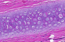 <p>Which cartilage is shown in the following image?</p>