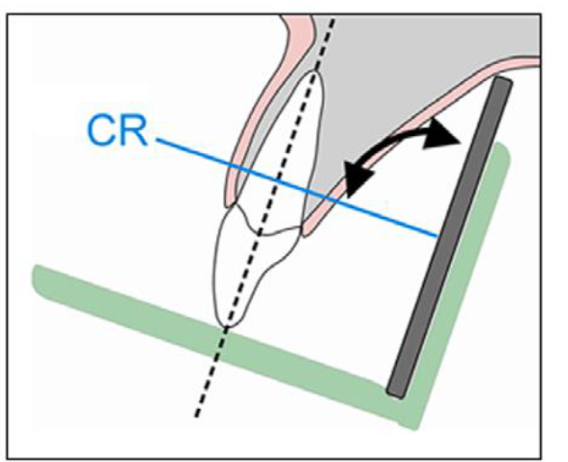 <ul><li><p>the x-ray beam should be directed perpendicular to the tooth and receptor</p></li></ul><p></p>