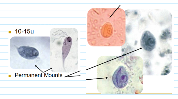 <ul><li><p><u>Tear drop shaped troph</u></p><ul><li><p>Eccentric nucleus usually visible</p><ul><li><p>Looks like a mouth</p></li></ul></li><li><p>10-15u</p></li></ul></li><li><p><u>Lemon shaped cyst (6-11u)</u></p></li></ul><p></p>