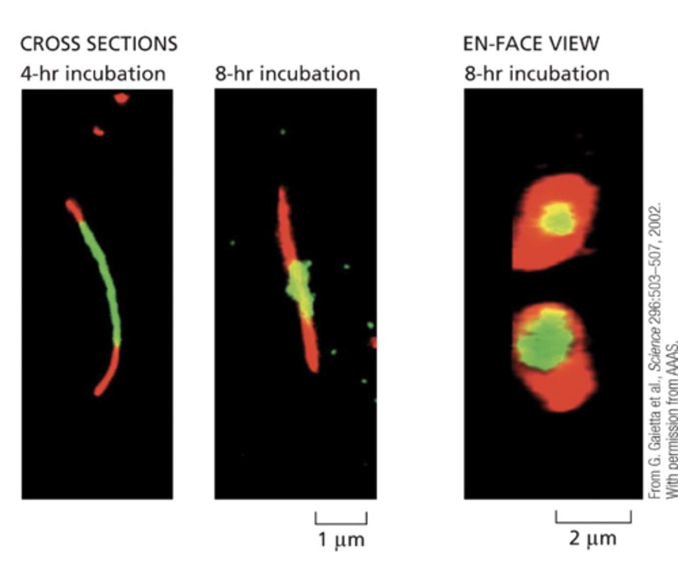 <p>Route of delivery of new connexons is via exocytosis; the ndiffusion in plane of membrane until encounter periphery of plaque and get trapped.</p>