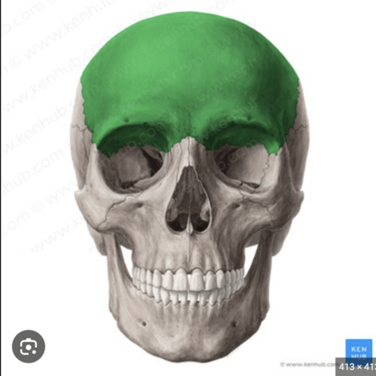<p>1. Anterior to the occipital bone</p><p>2. Forms the roof of the orbit</p><p>3. In the anterior cranial fossa</p><p>4. Contains a sinus</p><p>5. In the superior wall of the orbit</p><p>6. Immediately anterior to parietal bone</p>