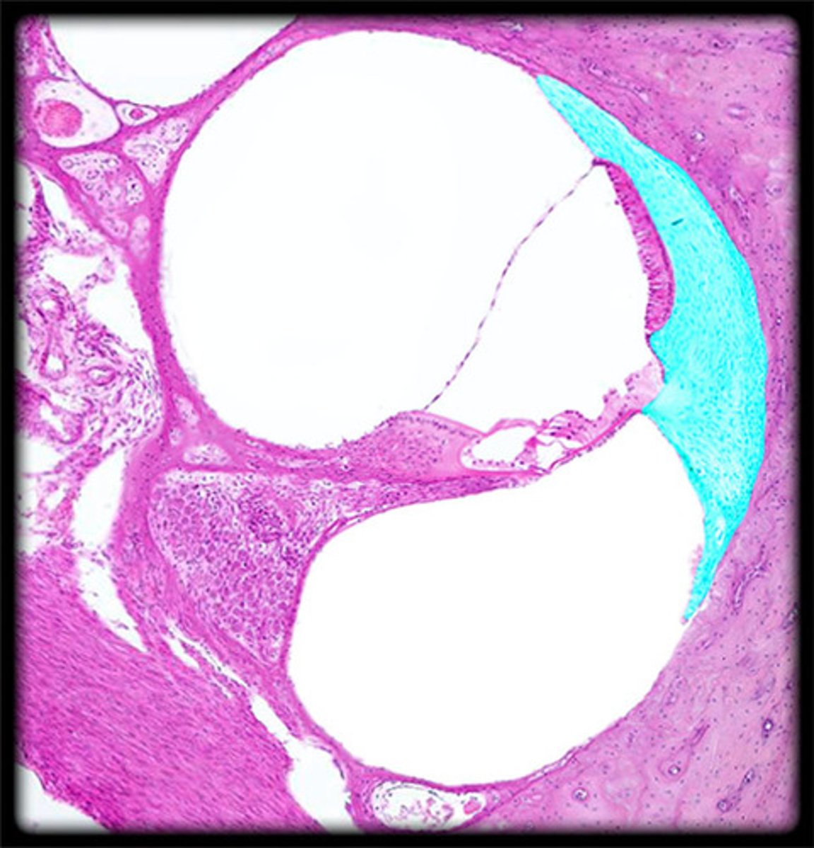 <p>fibrous connective tissue on the lateral wall of the cochlear duct that supports the lateral edge of the basilar membrane</p>