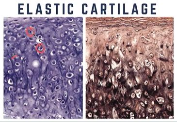 <p>Elastic Cartilage</p>