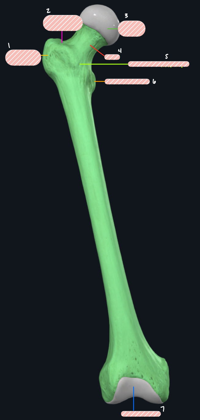<p>What bone is this?</p>