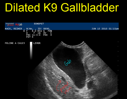 <p>Diseases of the gallbladder on Ultrasound</p>