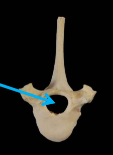 <p>What is the arrow pointing to?</p>