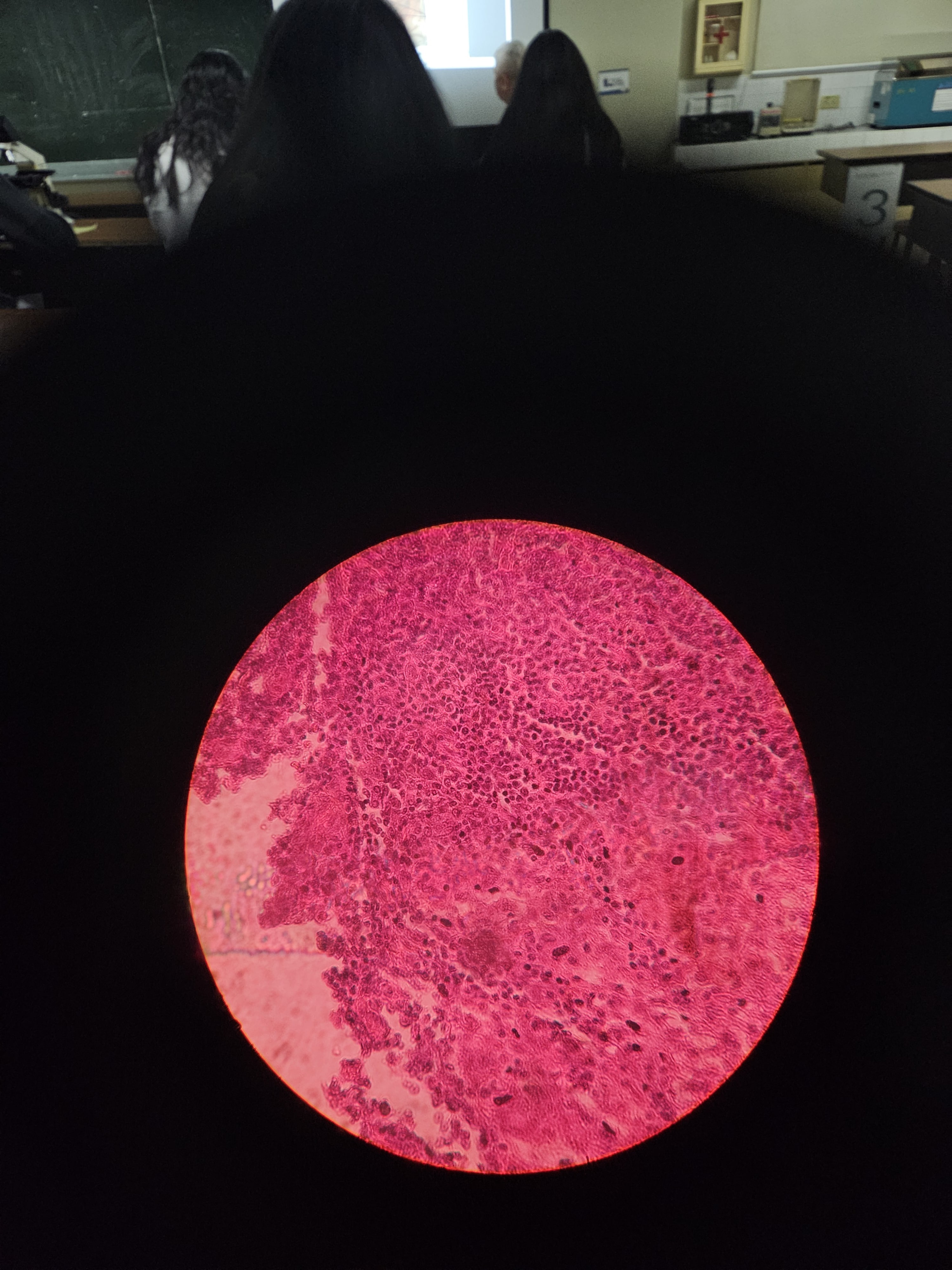 <p>What is the diagnosis?</p>