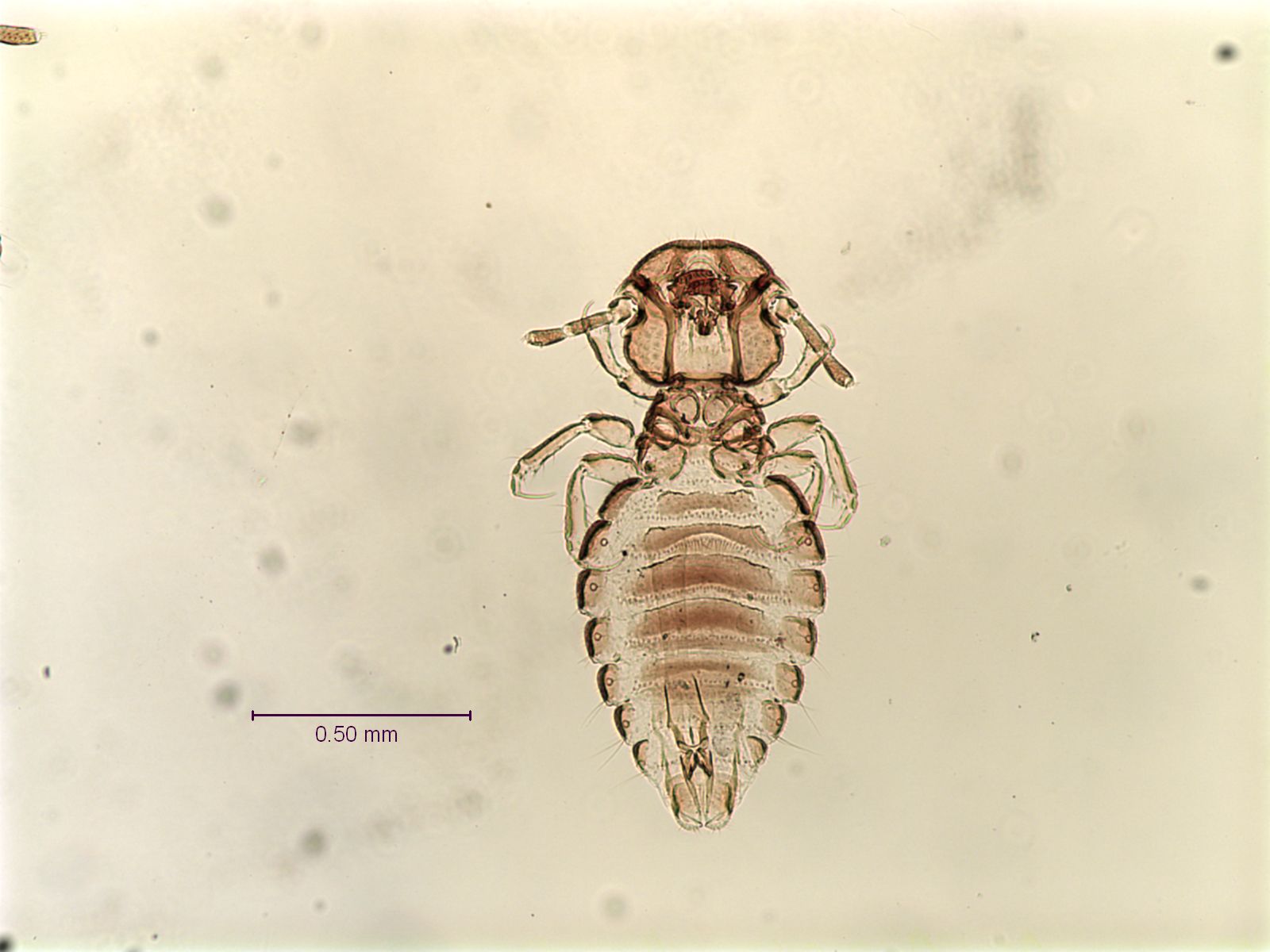 <p>Trichodectidae</p><p></p><p>•Filiform antennae</p><p>•Tarsi with one claw</p><p>-Hairy</p><p>-Head as wide or wider than thorax</p>