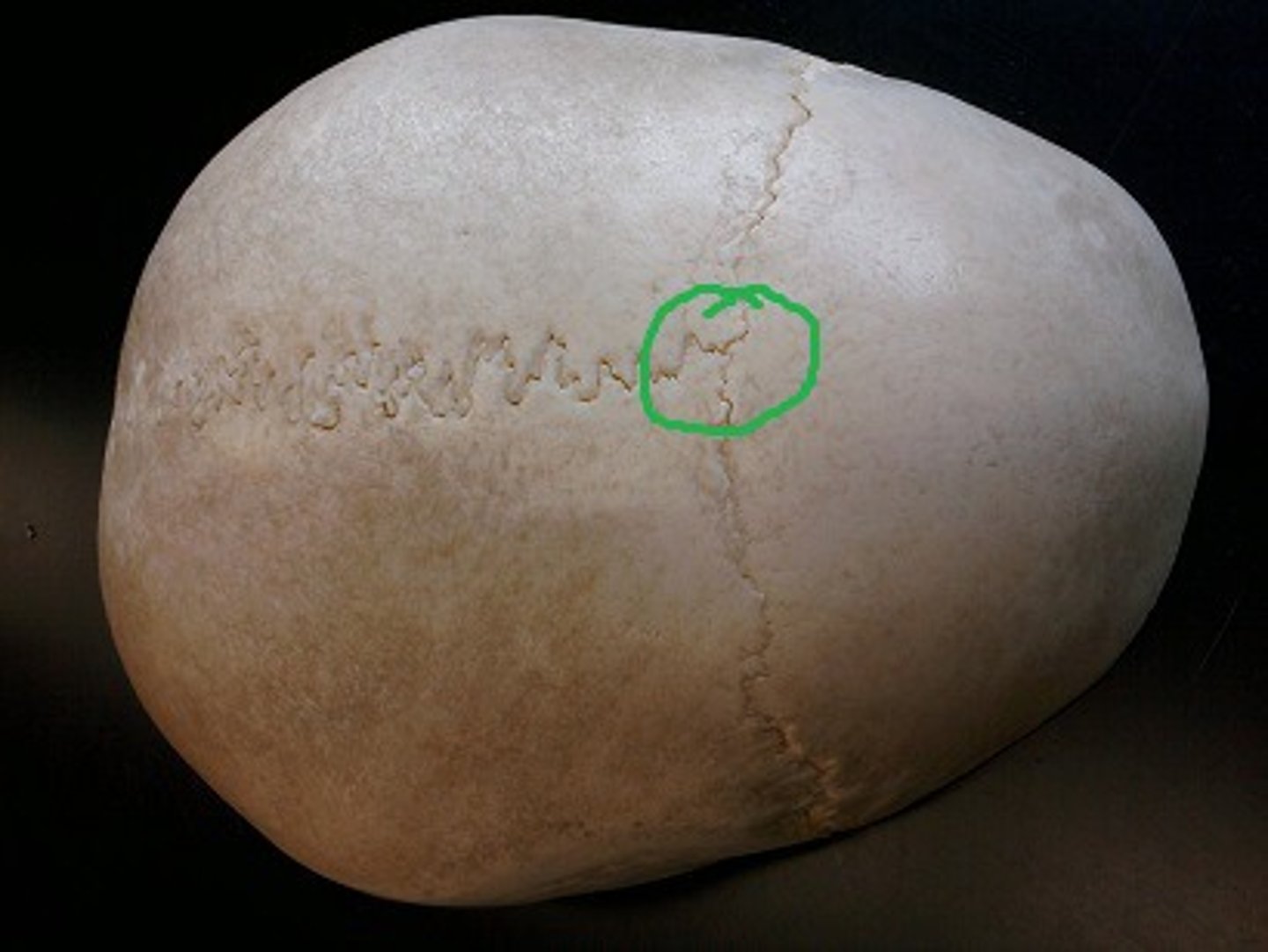 <p>A) Bregma</p><p>pg. 383: each end of the sagittal suture is identified as a point or area with a specific name as labeled. The anterior end of the sagittal suture is termed bregma.</p>