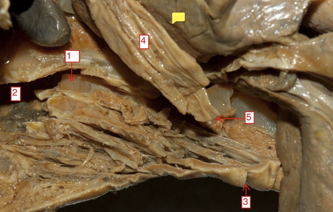 <p>spiny female dogfish- (5)</p>