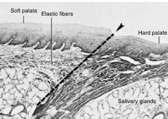 <ul><li><p>thin nonkeratinized epithelium overlying a thick lamina propria</p></li><li><p>lamina propria has numerous connective tissue papillae and distinct elastic layer for mobility </p></li><li><p>submucosa is extremely thin and has a firm attachment to underlying muscle for speech and swallowing. contains adipose CT (yellow color) and minor salivary glands</p><p></p></li></ul><p></p>