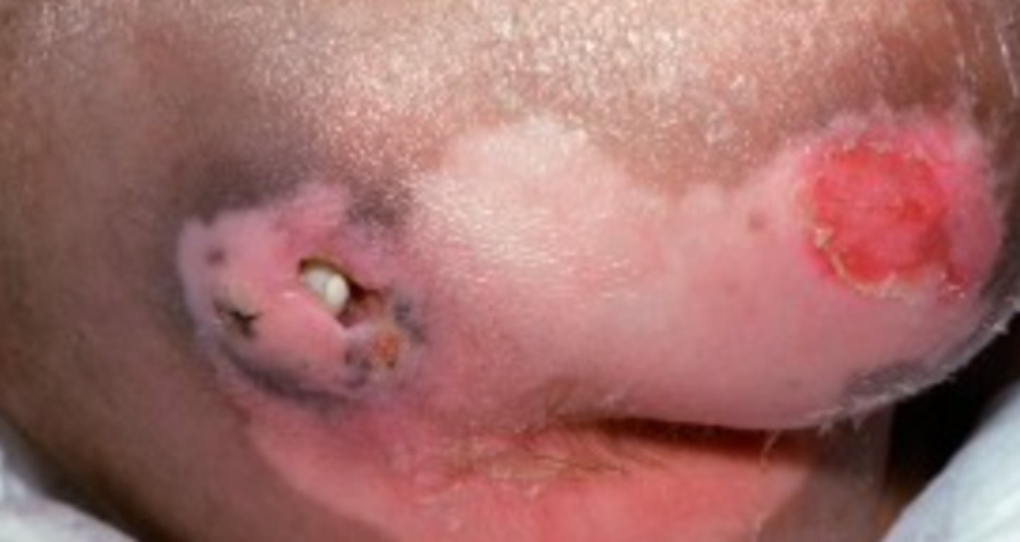 <p>What is the diagnosis?</p>