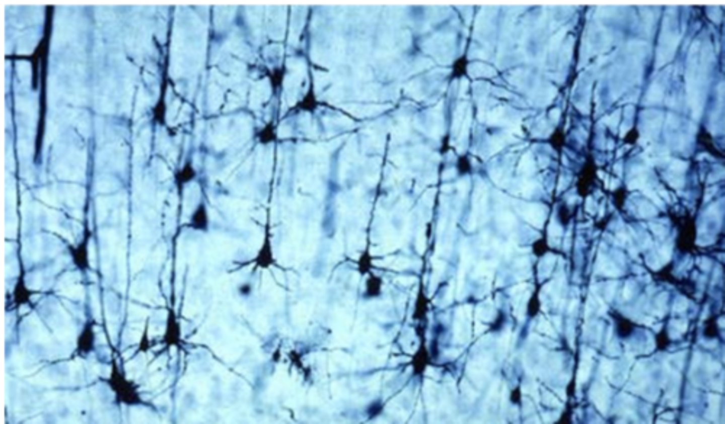 <p>Identify the cell</p>