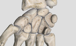 <p>gilding joints</p>