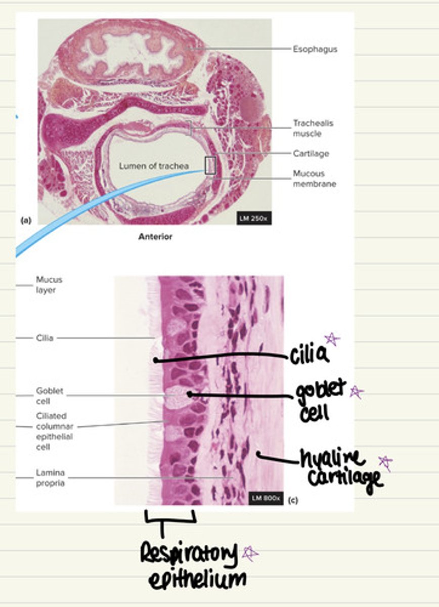 <p>i. Respiratory epithelium - pseudostratified columnar</p><p>epithelium</p><p>ii. Cilia</p><p>iii. Goblet cells</p><p>iv. Hyaline cartilage</p>