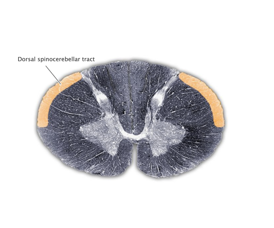 <p>Dorsal spinocerebellar tract</p>