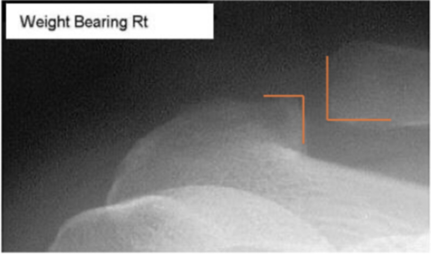 <p>What is the issue?</p>