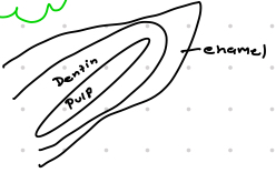 <p>Which type of scale is this?</p>