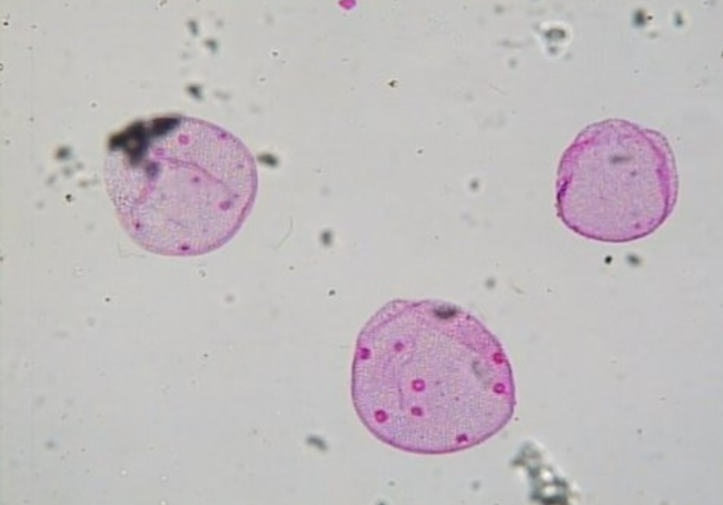 <p>Uses Flagella for movement</p>