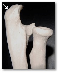 Name this specific part of the ulna.