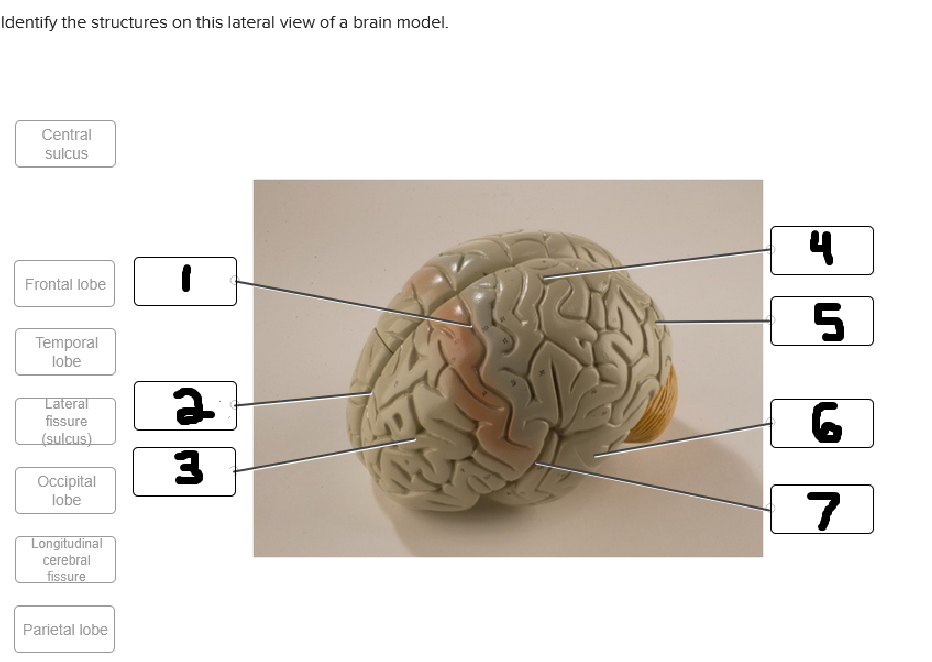 <p>whats labeled #7</p>