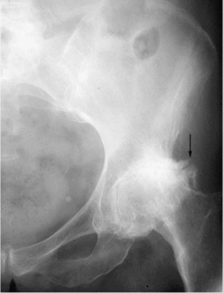 <p>Degenerative joint disease is a _____ disease</p>