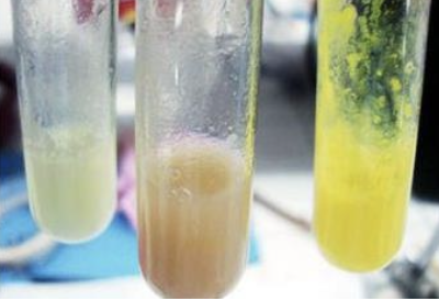 <p>What are the reagents in the 1st test tube (leftmost)?</p>