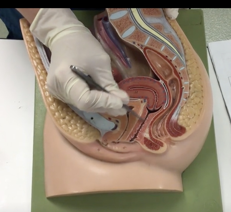 <p>Description: Muscular, hollow tube extending from the uterus to the vaginal orifice</p><p>Relationship: N/A</p>