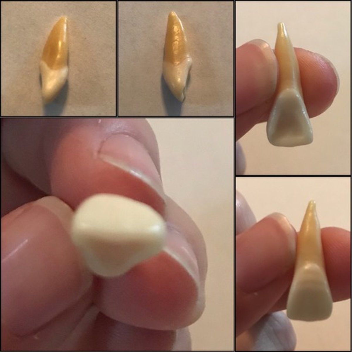 <p>What tooth is this ?</p>