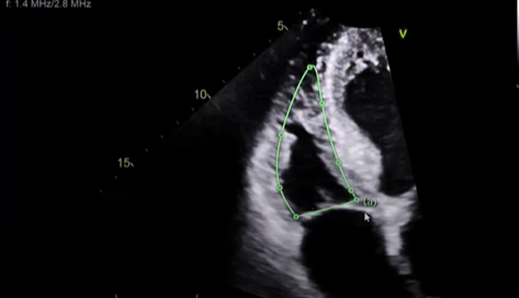 <p>what measurement is this </p>