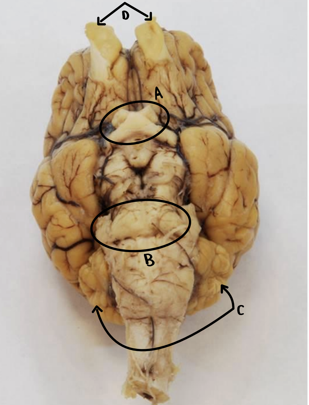 <p>Identify B</p>