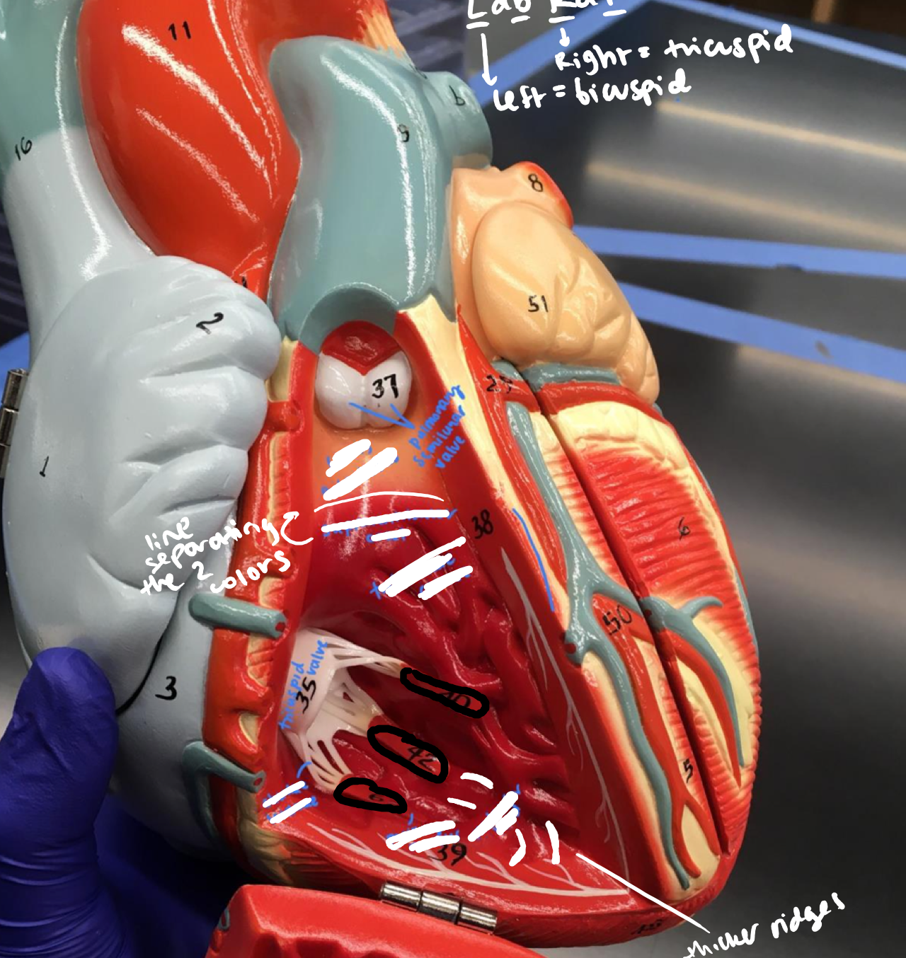 <p>The red connections from the trabeculae carnae and the chordae tendinae under the pulmonary semilunar valve</p>