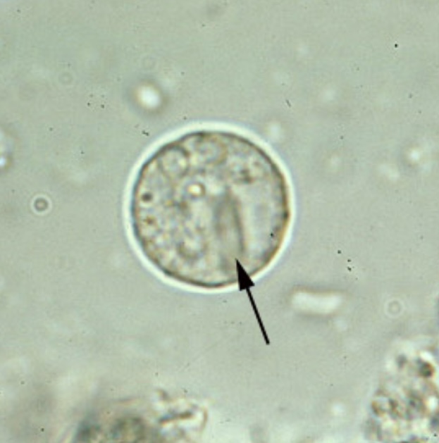 <p><span>Cyst of E. histolytica/E. dispar</span></p>