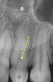 <p>what is the diagnosis? </p>