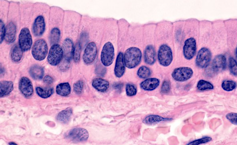 <p>looks like a layered sheet where the <strong>top row is tall “columns”</strong>, sitting on shorter cells underneath.</p><ul><li><p><strong>Basal layers</strong>: usually cuboidal or shorter cells that anchor the tissue.</p></li><li><p><strong>Apical (top) layer</strong>: elongated, rectangular <strong>columnar cells</strong> with oval nuclei near the base.</p></li></ul><p></p>