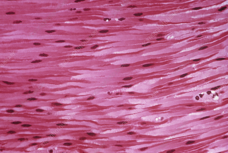 <p>smooth muscle tissue </p>