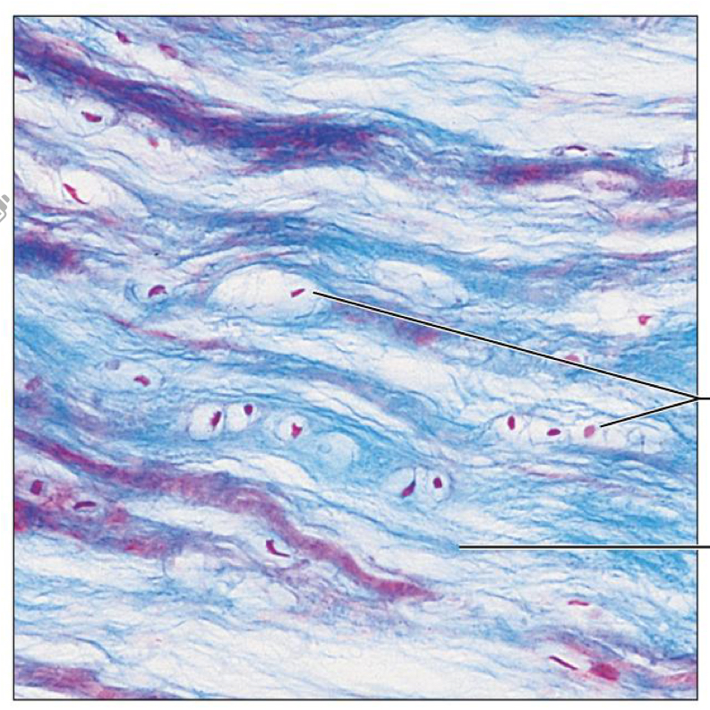 <p>What tissue is this</p>