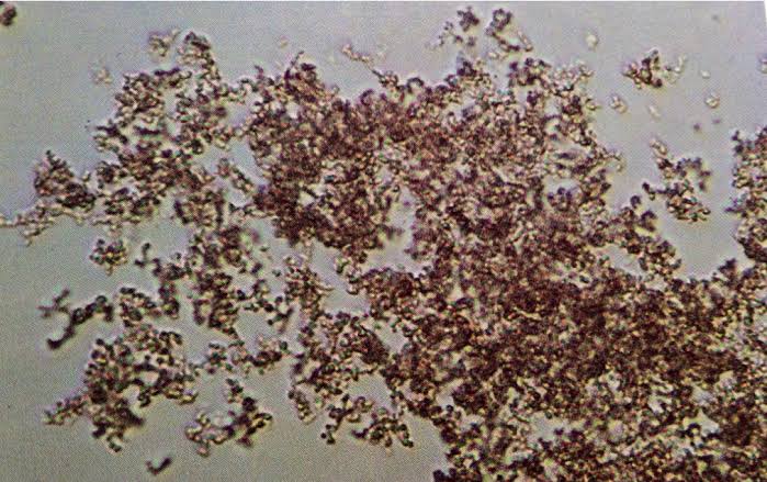 <ol><li><p>Identify crystals seen in acidic urine.</p></li><li><p>What is name of the pigment in these crystals?</p></li></ol><p></p>