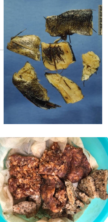 <p>False. EG toxicity happens all year round because in addition to accidental exposures, malicious exposures. </p>
