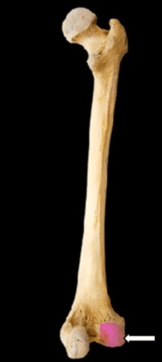 <p>name the part</p>