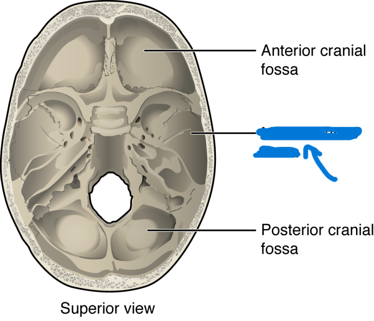 <p>What is this feature of the skull?</p>