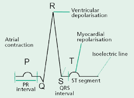 <p>Indicates atrial depolarization</p>