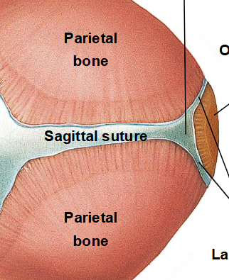 <ul><li><p>like a lambdoidal suture area </p></li></ul><p></p>