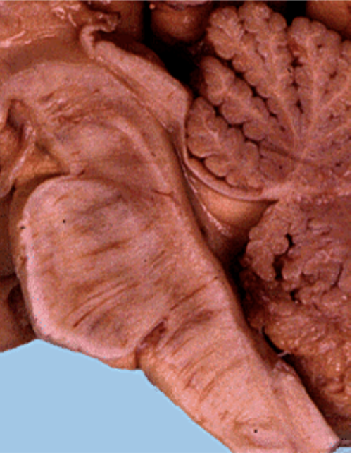 <ul><li><p>Conduit for ascending and descending tracts</p></li><li><p>Nuclei for second order sensory neurons (Cranial and spinal nerves)</p></li><li><p>Nuclei for lower motor neurons of the cranial nerves</p></li><li><p>Nuclei for critical neuroransmitter and neurohormones</p></li><li><p>Nuclei for life supporting autonomic functions</p></li></ul><p></p>